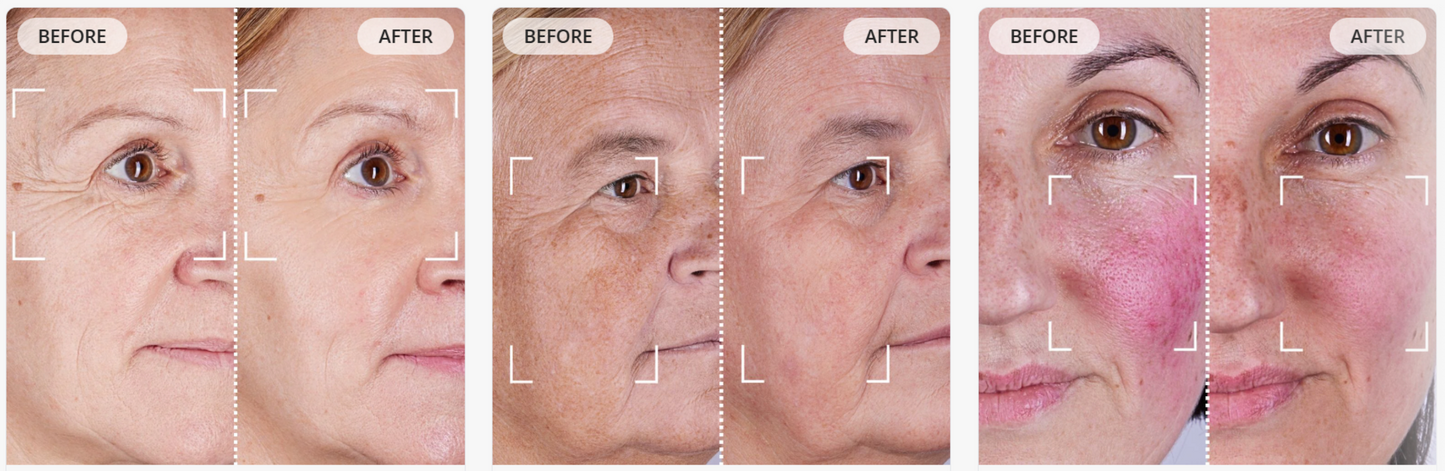 4 in 1 Red and Near-Infrared Light Therapy Mask