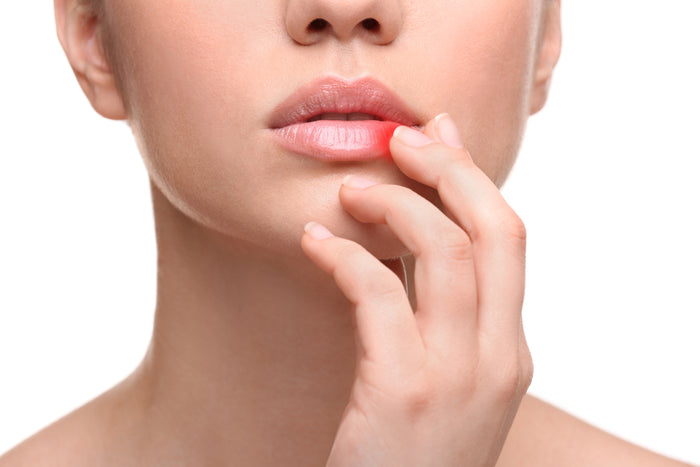 Red Light Therapy for Cold Sores: Can It Speed Up Healing?