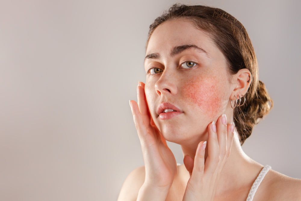 Red Light Therapy for Rosacea: What Helps and What Makes It Worse